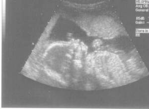 ultrasound2.jpg